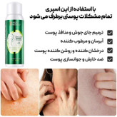 اسپری ضد جوش بدن سیازو